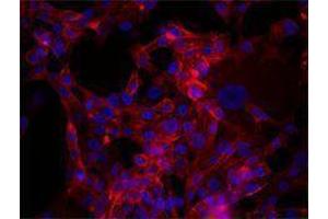 Immunofluorescence (IF) image for anti-CD44 (CD44) antibody (Alexa Fluor 647) (ABIN2657791) (CD44 Antikörper  (Alexa Fluor 647))