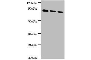 Western blot All lanes: CDH6 antibody at 6 μg/mL Lane 1: 293T whole cell lysate Lane 2: Hela whole cell lysate Lane 3: A549 whole cell lysate Secondary Goat polyclonal to rabbit IgG at 1/10000 dilution Predicted band size: 89, 74 kDa Observed band size: 89 kDa (CDH6 Antikörper  (AA 1-250))