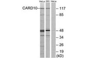 Western blot analysis of extracts from HeLa/293 cells, using CARD10 Antibody.