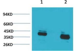 Western Blot (WB) analysis of 1) Mouse Brain Tissue, 2) Rat Brain Tissue with CABP Rabbit Polyclonal Antibody diluted at 1:2000. (S100G Antikörper)