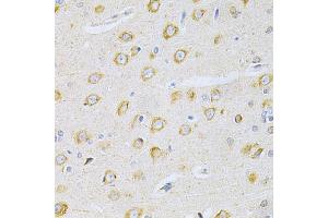Immunohistochemistry of paraffin-embedded rat brain using OLR1 Antibody. (OLR1 Antikörper)