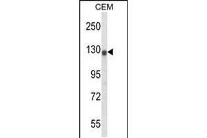 Western blot analysis of KCNH2 Antibody in CEM cell line lysates (35ug/lane) (KCNH2 Antikörper  (AA 861-888))