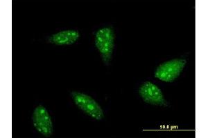 Immunofluorescence of monoclonal antibody to RNF6 on HeLa cell. (RNF6 Antikörper  (AA 1-100))
