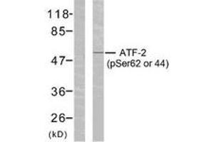 Western blot analysis of extracts from HeLa cells treated with TNF-alpha, using ATF2 (Phospho-Ser62 or 44) Antibody. (ATF2 Antikörper  (pSer62))