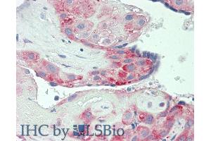Immunohistochemistry (IHC) image for anti-Tumor Necrosis Factor (Ligand) Superfamily, Member 8 (TNFSF8) (AA 68-231) antibody (ABIN7431086)
