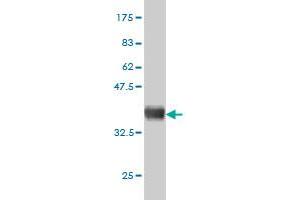 Western Blotting (WB) image for anti-Galactosidase, beta 1 (GLB1) (AA 578-677) antibody (ABIN561048)