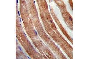 KEAP1 antibody immunohistochemistry analysis in formalin fixed and paraffin embedded human skeletal muscle. (KEAP1 Antikörper  (AA 422-449))