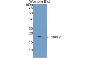 Detection of Recombinant MAPKSP1, Human using Polyclonal Antibody to Mitogen Activated Protein Kinase Scaffold Protein 1 (MAPKSP1) (MAPKSP1 Antikörper  (AA 1-124))