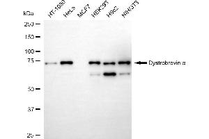 anti-Dystrobrevin alpha (DTNA) antibody