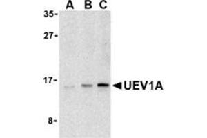 Western blot analysis of UEV1A in Jurkat cell lysates with this product at (A) 1, (B) 2, and (C) 4 μg/ml. (UBE2V1 Antikörper  (C-Term))
