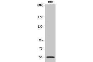 Western Blotting (WB) image for anti-Cytochrome P450, Family 2, Subfamily D, Polypeptide 6 (CYP2D6) (Internal Region) antibody (ABIN3184181) (CYP2D6 Antikörper  (Internal Region))