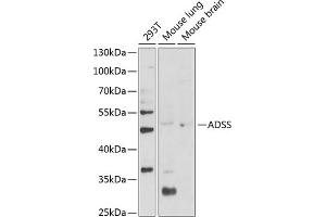 Western blot analysis of extracts of various cell lines, using ADSS Antibody (ABIN6131467, ABIN6136604, ABIN6136606 and ABIN6216015) at 1:1000 dilution. (ADSS Antikörper  (AA 1-280))