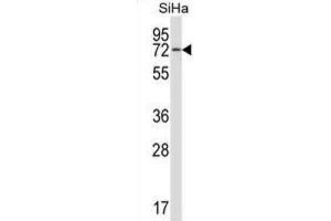 Western Blotting (WB) image for anti-Heat Shock 70kD Protein 12B (HSPA12B) antibody (ABIN2997411) (HSPA12B Antikörper)