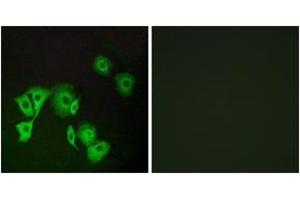 Immunofluorescence analysis of A549 cells, using TTF2 Antibody. (TTF2 Antikörper  (AA 51-100))