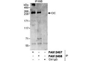 Detection of Human CIC/Capicua by Western blot and Immunoprecipitation. (CIC Antikörper)