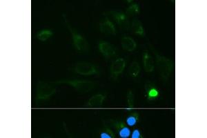 Immunofluorescence analysis of MCF-7 cells using UGT1A9 Polyclonal Antibody (UGT1A9 Antikörper)
