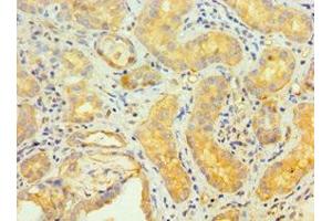 Immunohistochemistry of paraffin-embedded human kidney tissue using ABIN7173838 at dilution of 1:100 (TNFRSF1D (AA 257-386) Antikörper)