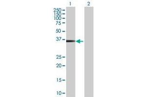 Lane 1: HOXB5 transfected lysate ( 29. (HOXB5 293T Cell Transient Overexpression Lysate(Denatured))