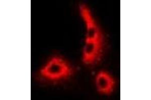Immunofluorescent analysis of Dermcidin staining in MCF7 cells.