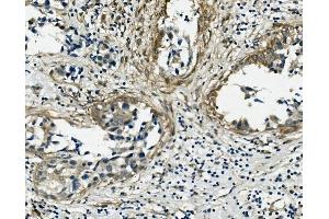 IHC analysis of VCL using anti-VCL antibody (ABIN7599003).