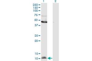Western Blot analysis of CCL2 expression in transfected 293T cell line by CCL2 monoclonal antibody (M11), clone 3H7.