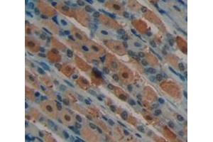Used in DAB staining on fromalin fixed paraffin- embedded Kidney tissue (NUAK1 Antikörper  (AA 404-651))