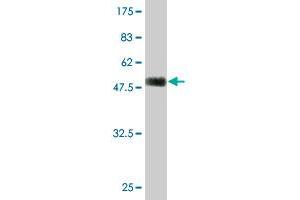 Western Blot detection against Immunogen (51. (TGIF2 Antikörper  (AA 1-237))