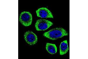 Confocal immunofluorescent analysis of PIP5KL1 Antibody (N-term) (ABIN655244 and ABIN2844847) with U-251MG cell followed by Alexa Fluor 488-conjugated goat anti-rabbit lgG (green). (PIP5KL1 Antikörper  (N-Term))