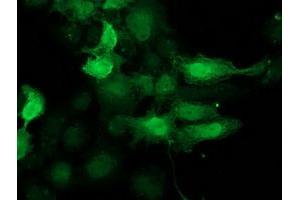 Anti-CDK2 mouse monoclonal antibody (ABIN2454600) immunofluorescent staining of COS7 cells transiently transfected by pCMV6-ENTRY CDK2 (RC200494). (CDK2 Antikörper)