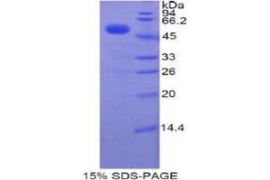 SDS-PAGE analysis of Human TFAM Protein. (TFAM Protein)