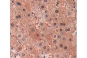 IHC-P analysis of Human Tissue, with DAB staining. (MT1E Antikörper  (AA 1-61))