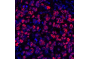 Immunofluorescence (IF) image for anti-SRY (Sex Determining Region Y)-Box 10 (SOX10) (AA 416-466) antibody (ABIN7455186)