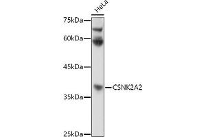 Western blot analysis of extracts of HeLa cells, using CSNK2 antibody (ABIN3022252, ABIN3022253, ABIN3022254 and ABIN6218695) at 1:1000 dilution.