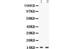 Anti-FABP6 antibody, Western blottingAll lanes: Anti FABP6  at 0. (FABP6 Antikörper  (N-Term))