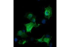 Image no. 2 for anti-RAB30, Member RAS Oncogene Family (RAB30) antibody (ABIN1500559)