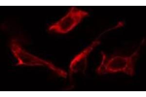 ABIN6266758 staining NIH-3T3 cells by IF/ICC. (MAN1B1 Antikörper  (Internal Region))