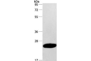 Western Blot analysis of Human fetal muscle tissue using CAV3 Polyclonal Antibody at dilution of 1:500