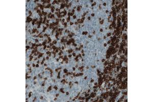 Immunohistochemical staining (Formalin-fixed paraffin-embedded sections) of human tonsil with CD3E monoclonal antibody, clone CL1497  shows strong positivity in a subset of lymphoid cells. (CD3 epsilon Antikörper  (AA 25-126))