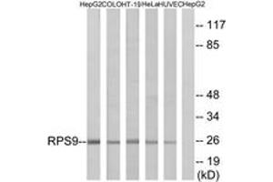 Western blot analysis of extracts from HepG2/COLO/HT-29/HeLa/HuvEc cells, using RPS9 Antibody. (RPS9 Antikörper  (AA 31-80))