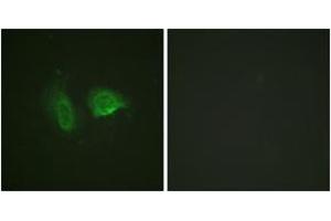 Immunofluorescence (IF) image for anti-Calcium-Sensing Receptor (CASR) (AA 854-903), (pThr888) antibody (ABIN1531528)