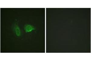Immunofluorescence analysis of HeLa cells, using Calcium Sensing Receptor (Phospho-Thr888) Antibody. (CASR Antikörper  (pThr888))