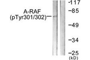 Western blot analysis of extracts from HeLa cells treated with PMA 125ng/ml 30', using A-RAF (Phospho-Tyr302) Antibody. (ARAF Antikörper  (pTyr302))