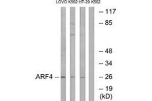 Western blot analysis of extracts from LOVO/K562/HT-29 cells, using ARF4 Antibody. (ARF4 Antikörper  (AA 71-120))