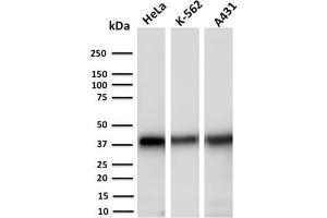 Western Blot Analysis of Human HeLa, K-562 and A431 cell lysates using AKR1C2 Mouse Monoclonal Antibody (CPTC-AKR1C2-1). (AKR1C2 Antikörper)