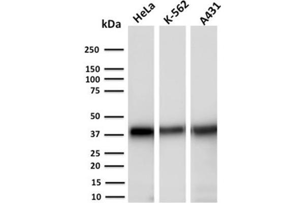 AKR1C2 Antikörper