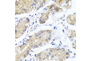 Immunohistochemistry of paraffin-embedded human gastric using PSTPIP1 antibody at dilution of 1:100 (x40 lens). (PSTPIP1 Antikörper)