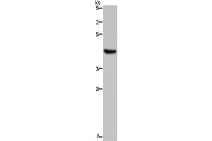 Western Blotting (WB) image for anti-Hydroxy-delta-5-Steroid Dehydrogenase, 3 beta- and Steroid delta-Isomerase 1 (HSD3B1) antibody (ABIN2430265)