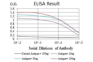 Black line: Control Antigen (100 ng), Purple line: Antigen(10 ng), Blue line: Antigen (50 ng), Red line: Antigen (100 ng), (ROCK1 Antikörper)