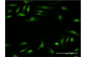 Immunofluorescence (IF) image for anti-Calcium Binding and Coiled-Coil Domain 2 (CALCOCO2) (AA 347-446) antibody (ABIN564431)