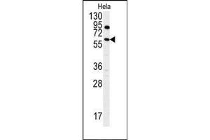 Image no. 1 for anti-anthrax Toxin Receptor 1 (ANTXR1) (AA 365-394), (Tyr382) antibody (ABIN360040)